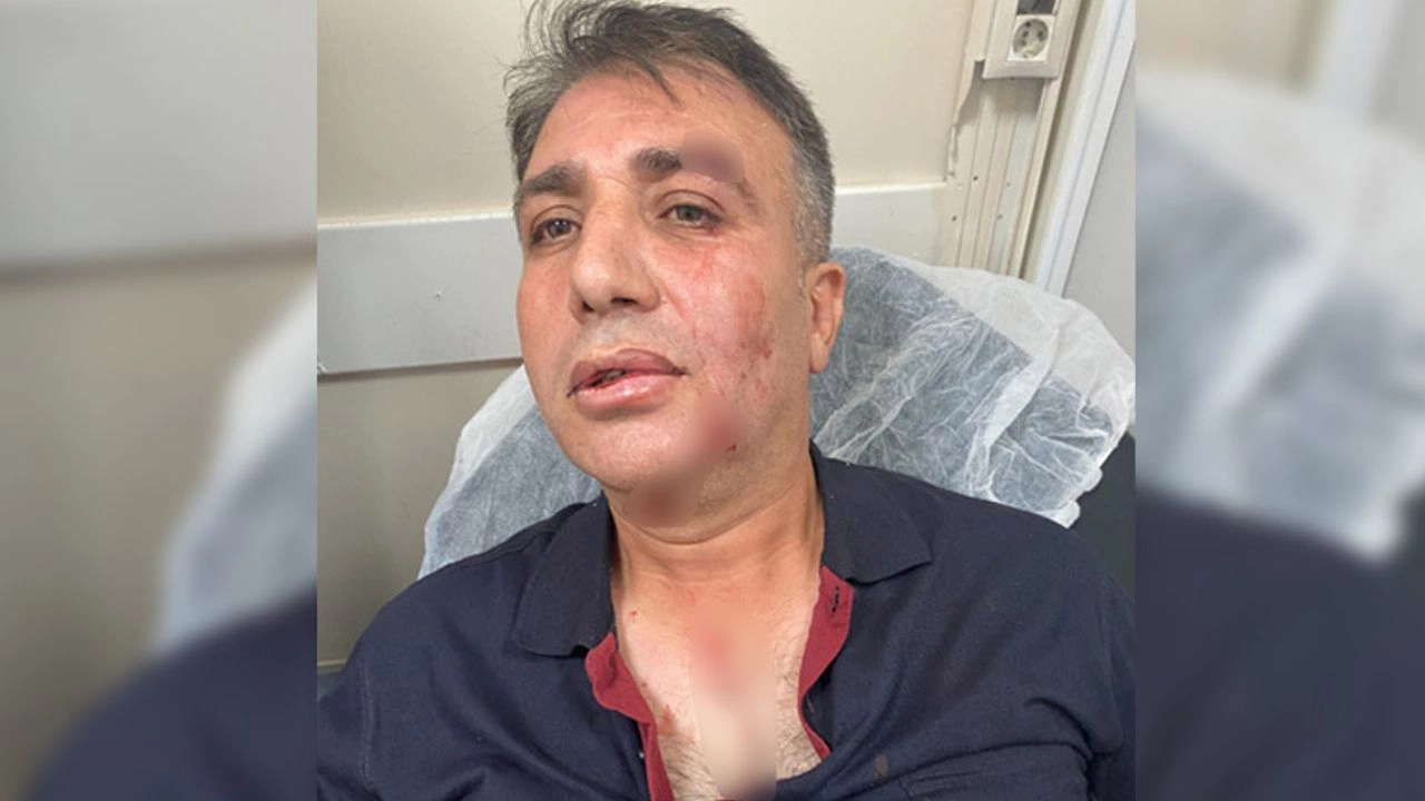 Sigara denetimi yapanlar darp edildi